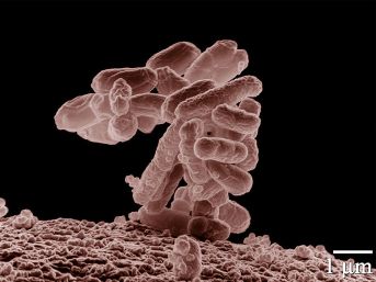 E coli, Wikimedia Commons